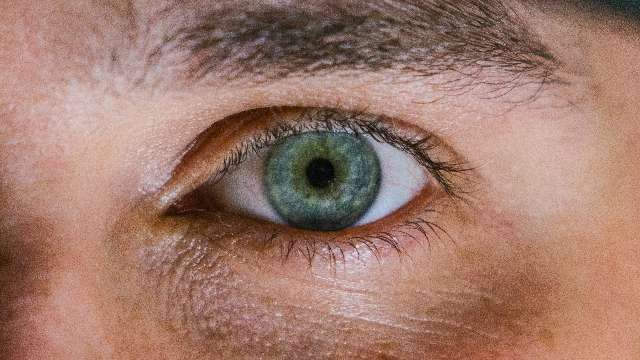 Kontaktlinser med Motiv – Et Syn på Stil